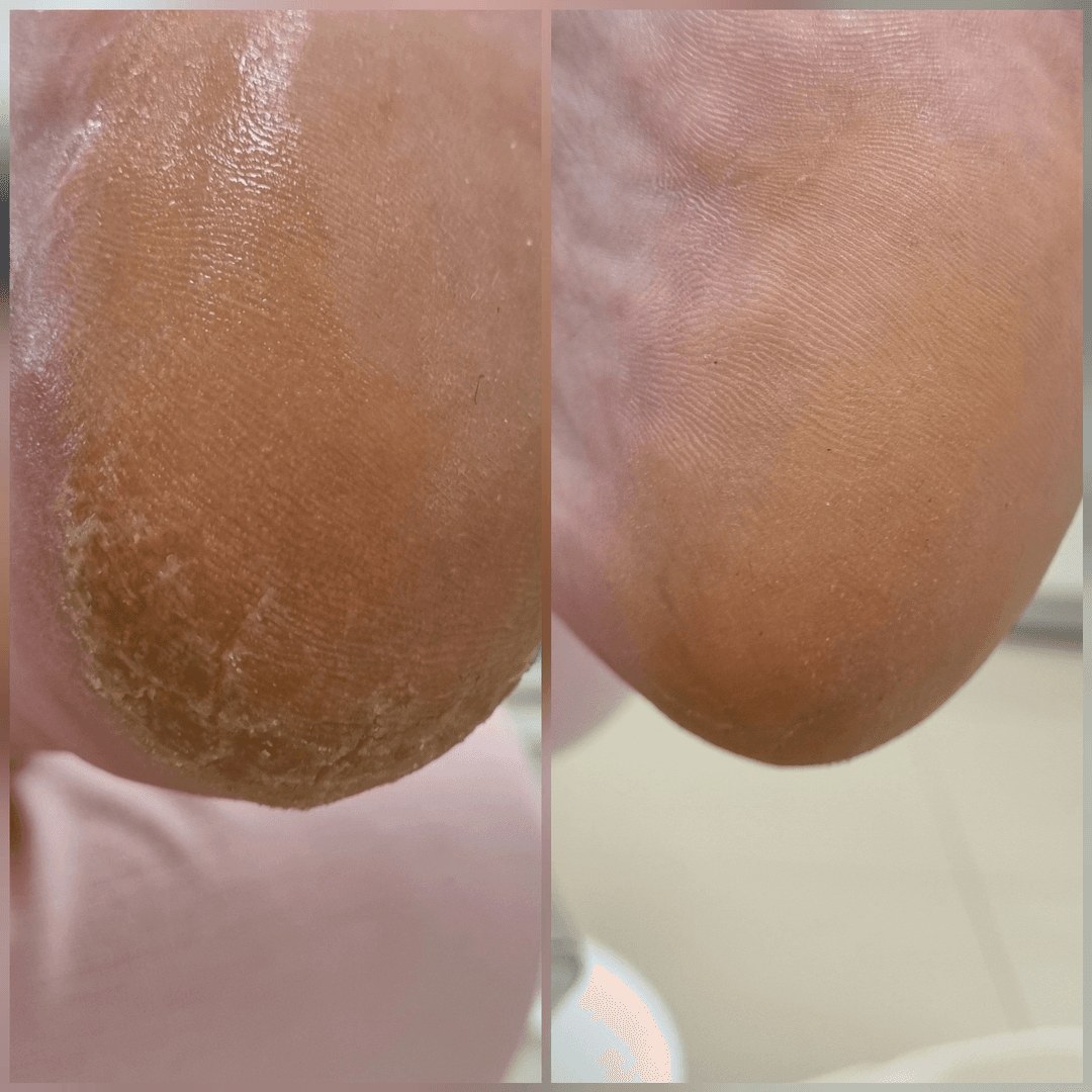 Profesionální pedikúra - ošetření a péče o nohy v Jihlavě