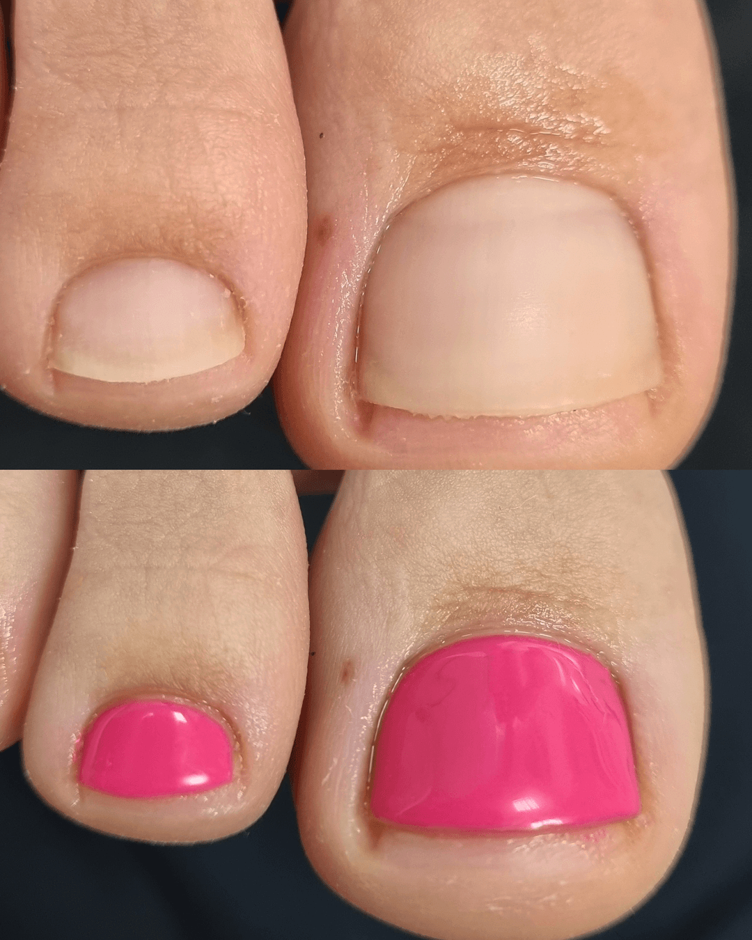 Přístrojová pedikúra s použitím moderních technologií